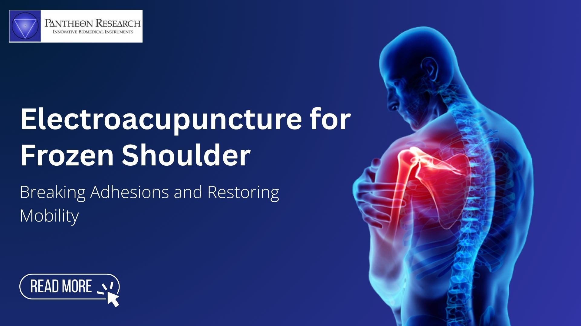 Electroacupuncture for Frozen Shoulder Electroacupuncture for Frozen Shoulder